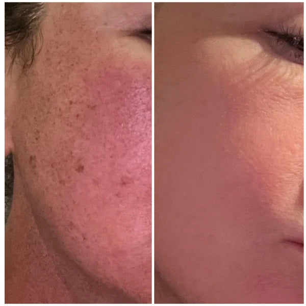 Customer-shared skincare comparison 4