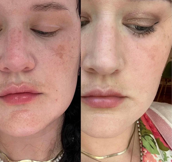 Customer before-and-after skincare photos, pair 2