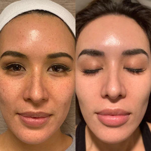 Customer before-and-after skincare photos, pair 3